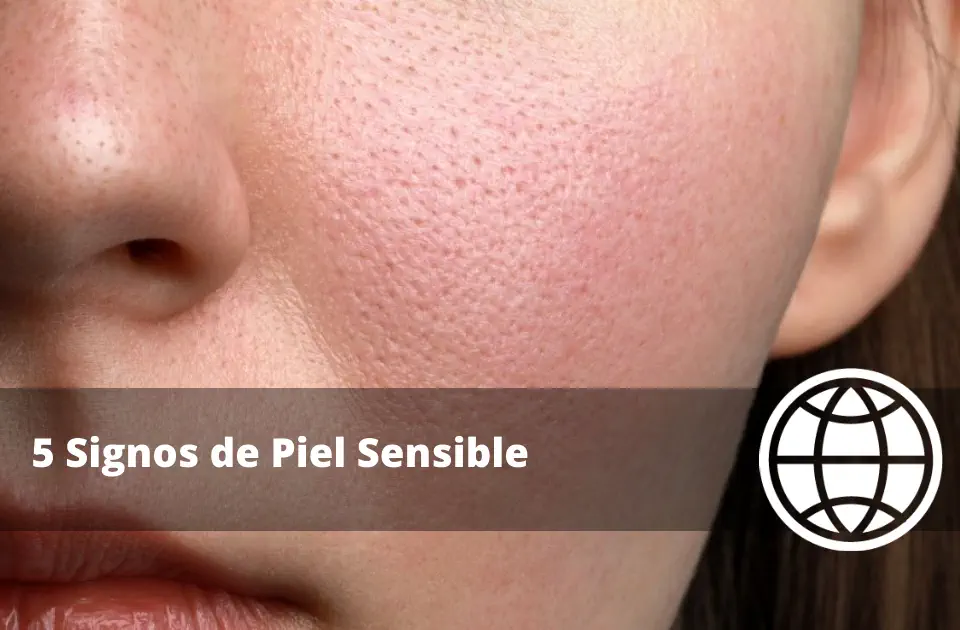 5 Signos de Piel Sensible